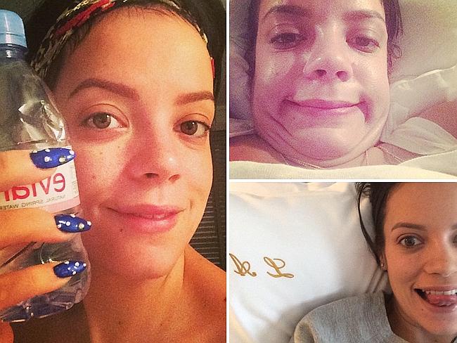 Forget those Instagram duckface dunces, Lily Allen is happy to let her barefaced beauty s