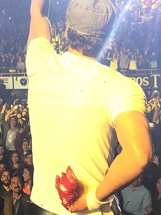 Enrique tries to hide his cut hand.